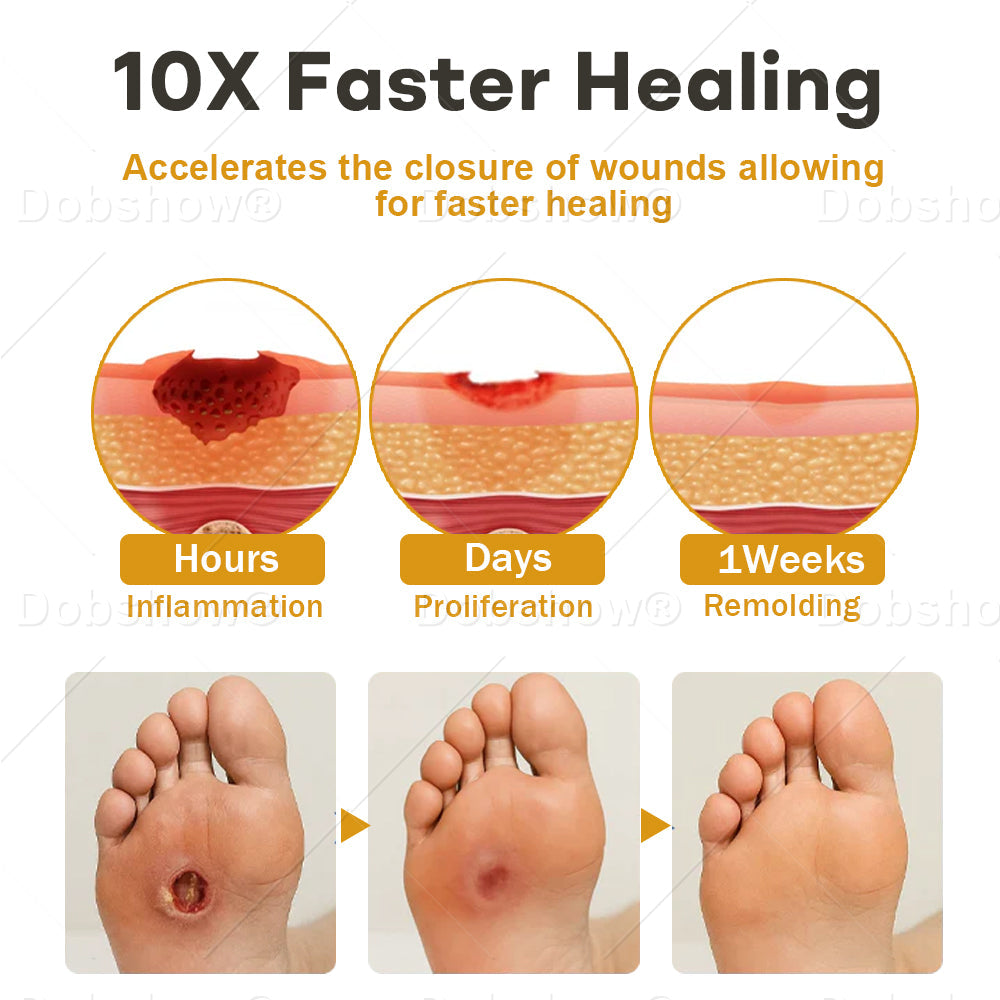 Healrize® GlucoShield  Wound Spray—— Supports Skin Repair & Protects Diabetic Feet