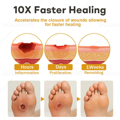 Healrize® GlucoShield  Wound Spray—— Supports Skin Repair & Protects Diabetic Feet