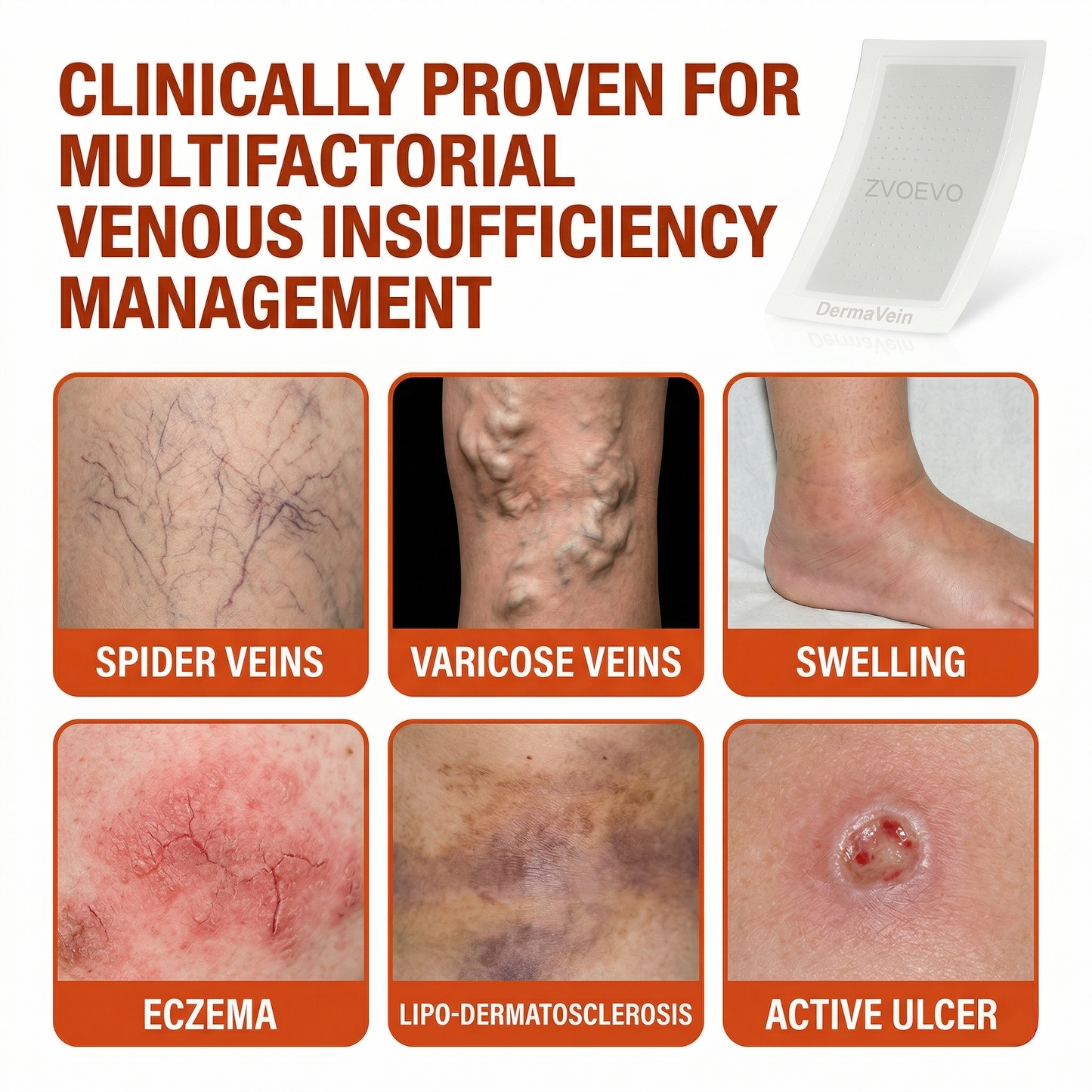 🔥 𝘽𝙚𝙨𝙩 𝙎𝙚𝙡𝙡𝙚𝙧 | Healrize® DermaVein Microneedle Patch-𝘝𝘪𝘴𝘪𝘣𝘭𝘦 𝘝𝘦𝘪𝘯 𝘙𝘦𝘥𝘶𝘤𝘵𝘪𝘰𝘯 𝘚𝘺𝘴𝘵𝘦𝘮