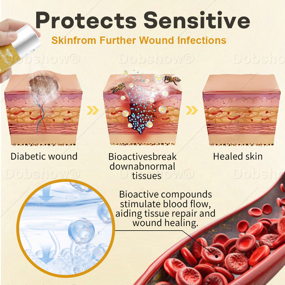 Healrize® GlucoShield  Wound Spray—— Supports Skin Repair & Protects Diabetic Feet