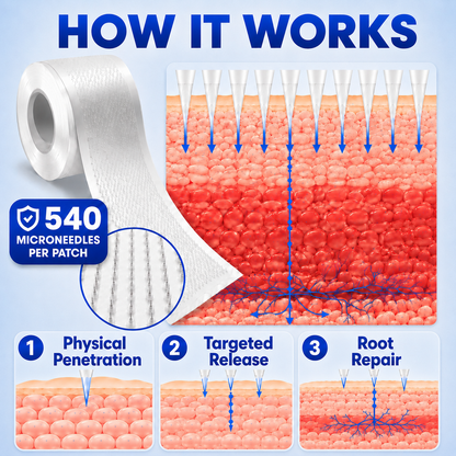 🌿Dobshow® Micro Needle Patch Roll | Advanced Daily Leg Care Patch✨