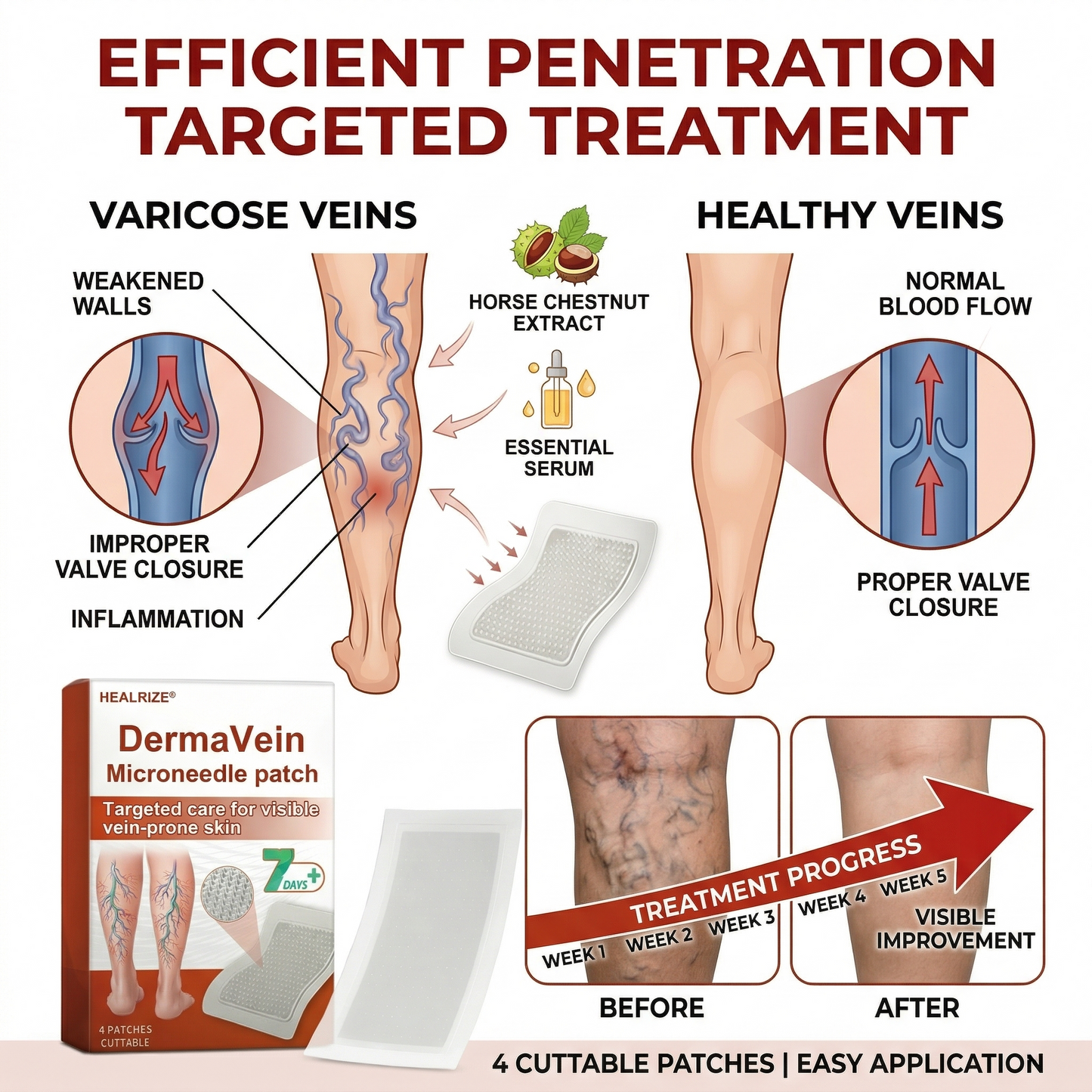 🔥 𝘽𝙚𝙨𝙩 𝙎𝙚𝙡𝙡𝙚𝙧 | Healrize® DermaVein Microneedle Patch-𝘝𝘪𝘴𝘪𝘣𝘭𝘦 𝘝𝘦𝘪𝘯 𝘙𝘦𝘥𝘶𝘤𝘵𝘪𝘰𝘯 𝘚𝘺𝘴𝘵𝘦𝘮