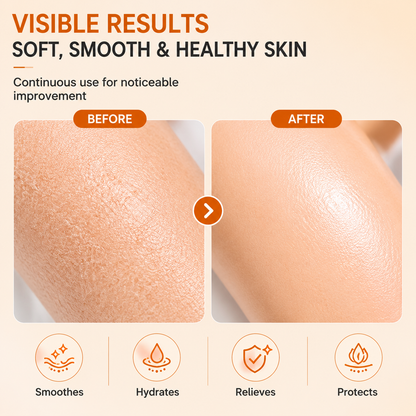 The High-Converting SEO Title (Most Recommended) Dobshow® Turmeric Ultra-Moisturizing Protective Balm - Anti-Cracking Hand & Foot Cream