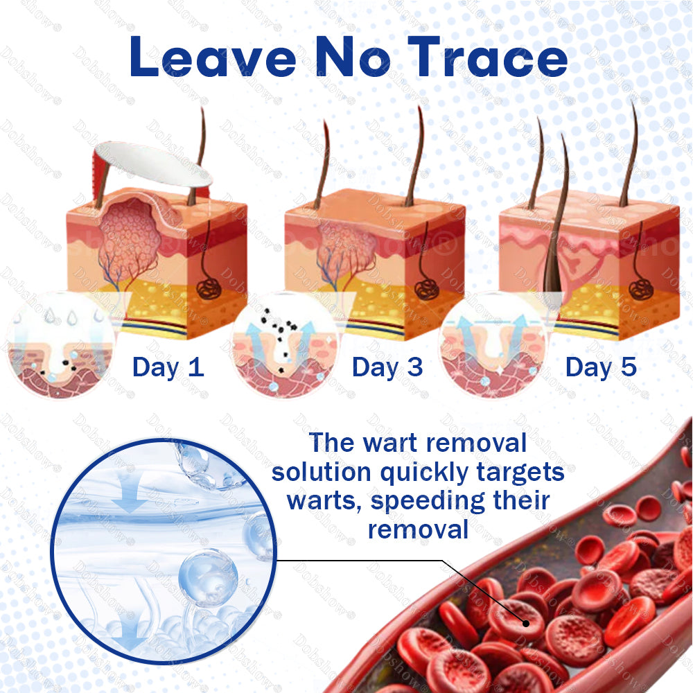 Healrize® 3-in-1 Microneedle & Hydrocolloid Skin Tag Patch