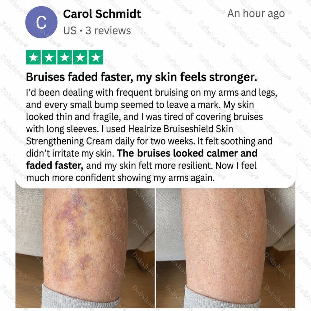 Dobshow® BRUISESHIELD Skin Strengthening Cream