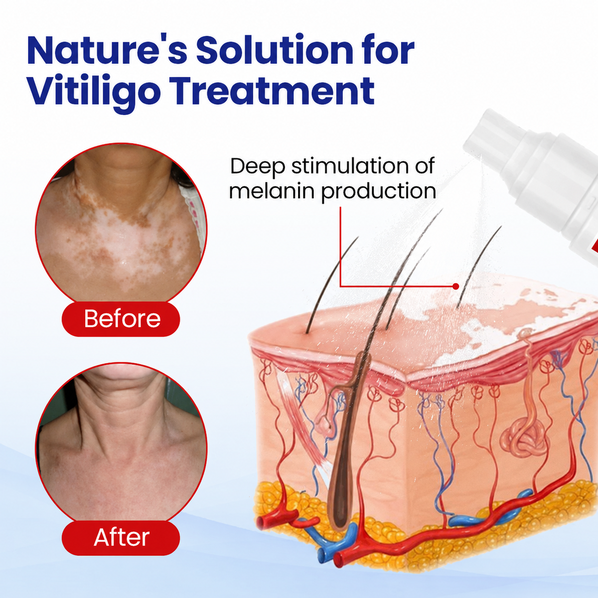 Dobshow® Pigment Balance Spray– Targeted Vitiligo & White Patch Care | Supports Melanin Production, Pigment Balance & Natural-Looking Skin Tone
