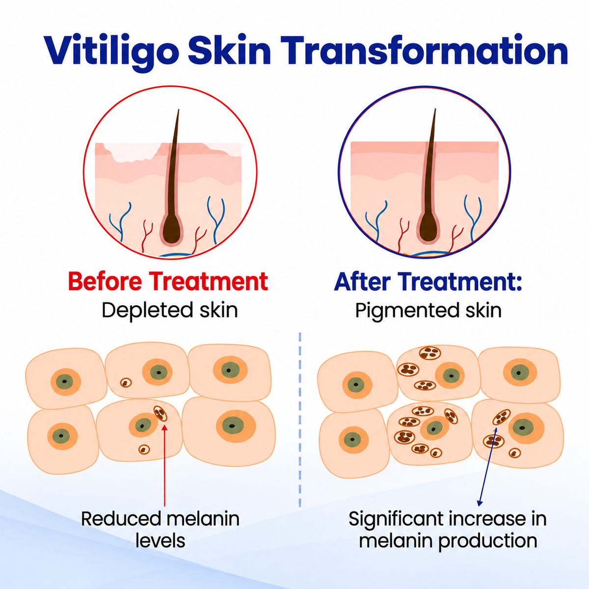 Dobshow® Pigment Balance Spray– Targeted Vitiligo & White Patch Care | Supports Melanin Production, Pigment Balance & Natural-Looking Skin Tone