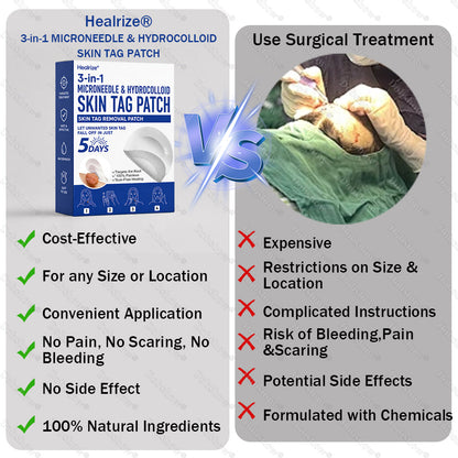 Healrize® 3-in-1 Microneedle & Hydrocolloid Skin Tag Patch